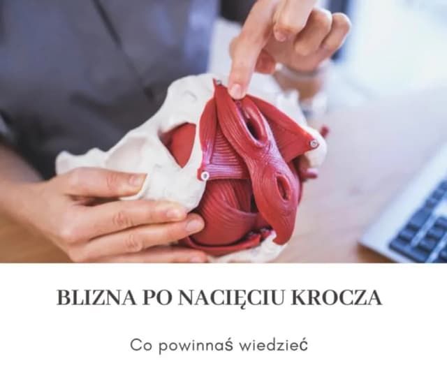 Jak dbać o krocze po porodzie: skuteczne sposoby na szybsze gojenie i komfort Jak dbać o krocze po porodzie: skuteczne sposoby na szybsze gojenie i komfort