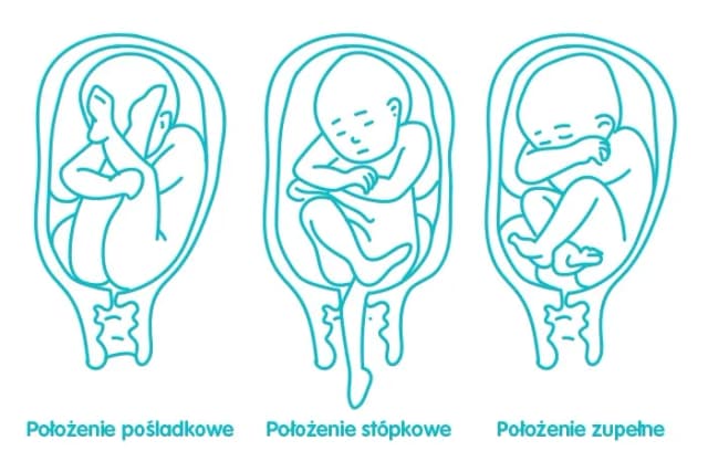 Jak rozpoznać poród? Objawy, które musisz znać, by nie przegapić ważnego momentu Jak rozpoznać poród? Objawy, które musisz znać, by nie przegapić ważnego momentu